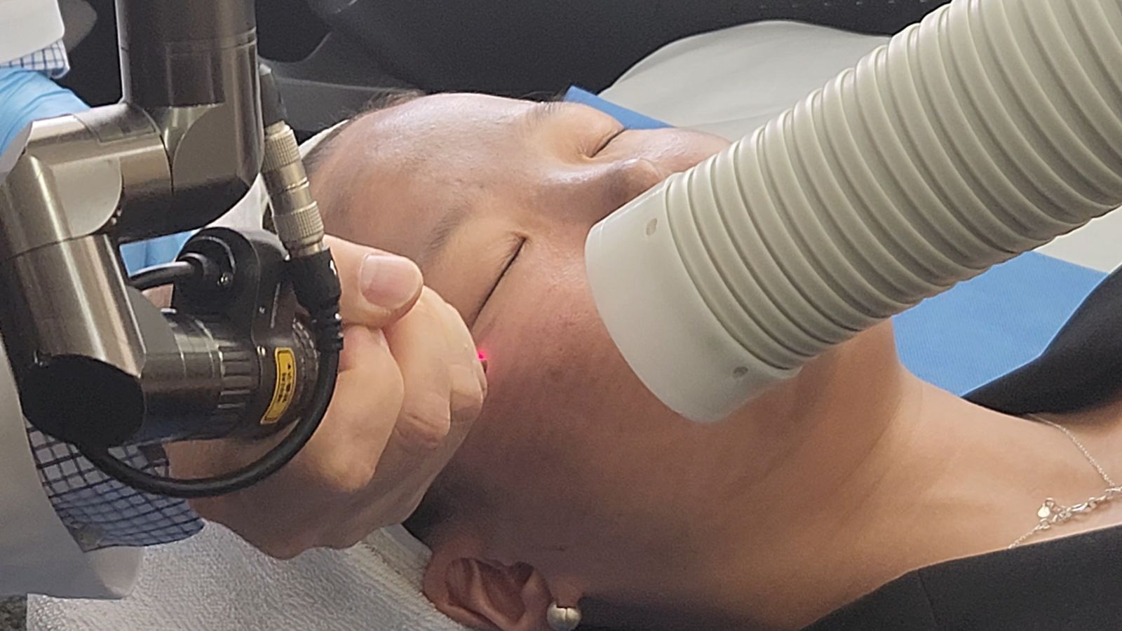 Acne Treatment (Gold PTT) at Yonsei Star Dermatology
